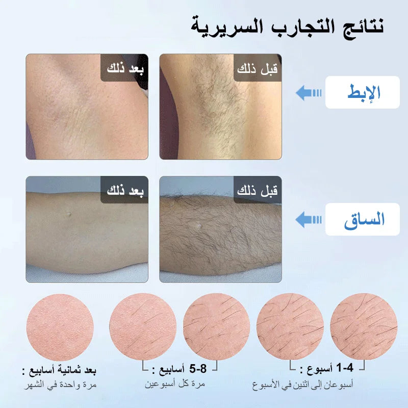 LAY T4 IPL Laser Handheld Hair Removal Machine Ice Cool Permanent Face Body Bikini Epilator with 500000 Shots for Home Use